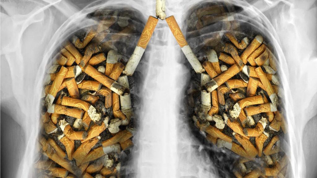 How to Beat Smoking ill Effects