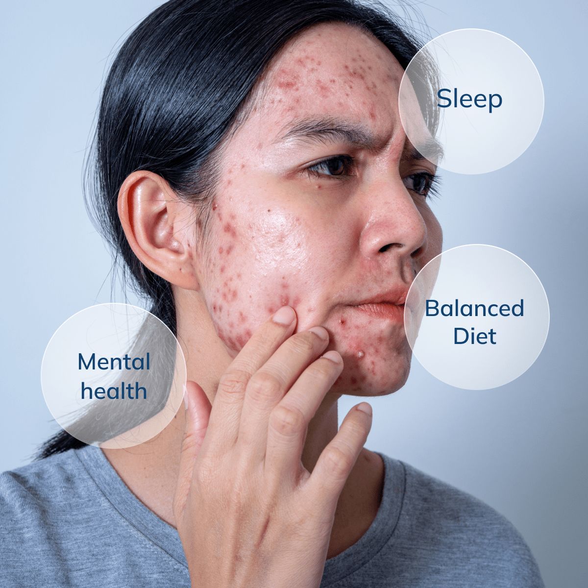 Skin care 2nd image