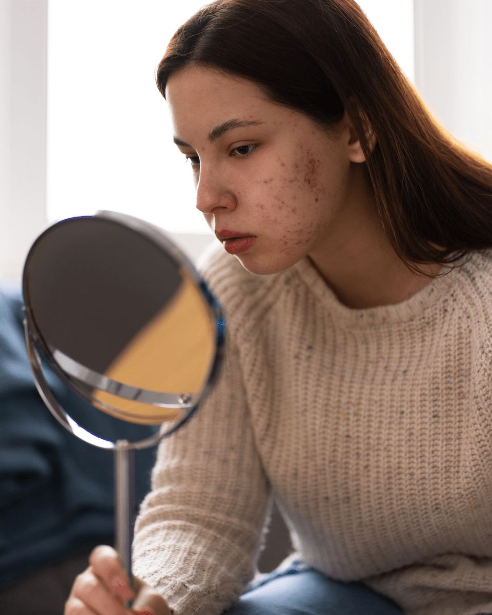 Skin Care Program