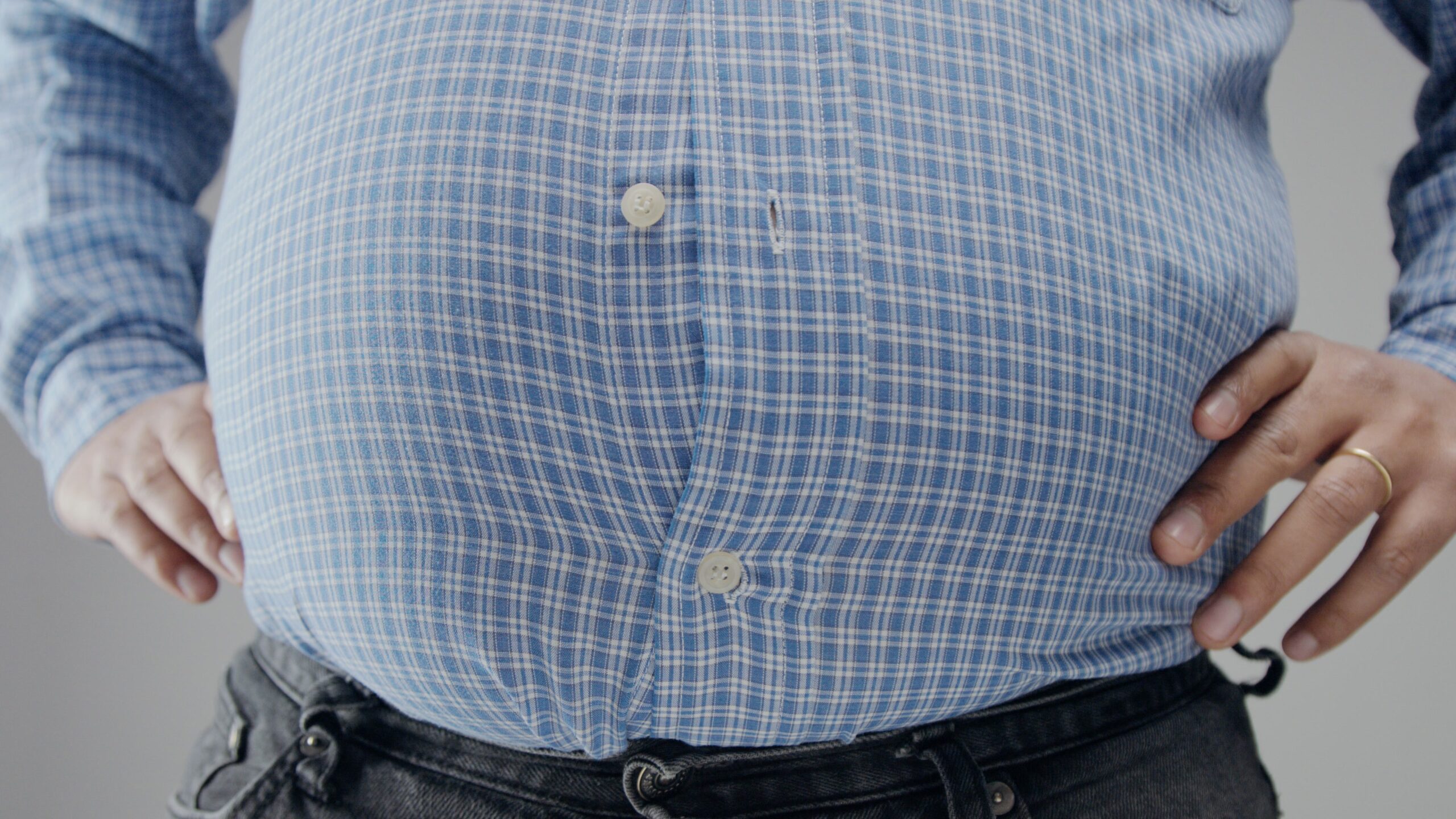 Sarcopenic Obesity: The Overlooked Link Between Muscle Loss and Weight Gain