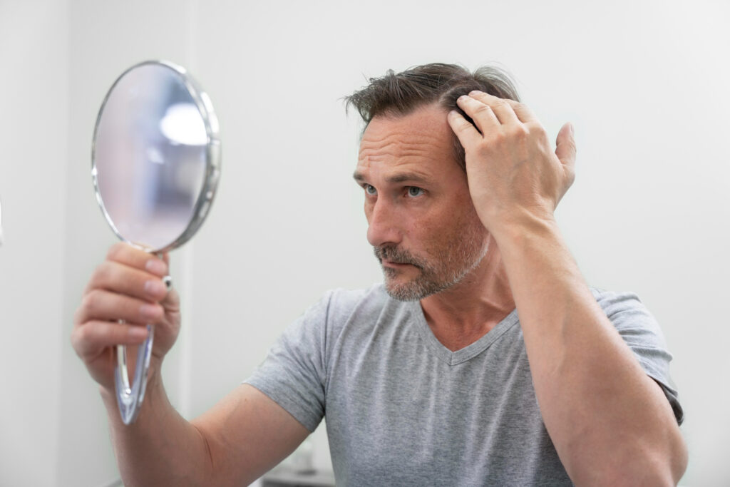 what is DHT in hair loss