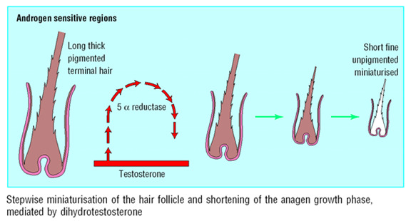 What Is DHT? Understanding the Hormone Behind Hair Loss and How to Manage It what is dht