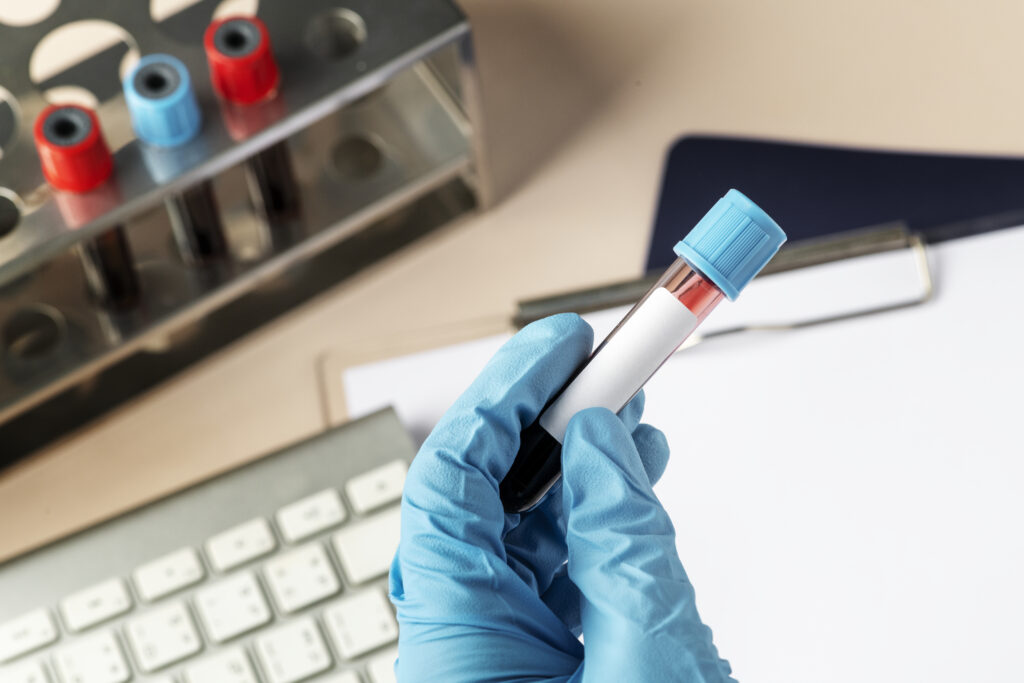 creatinine-egfr-cystatin-c-test