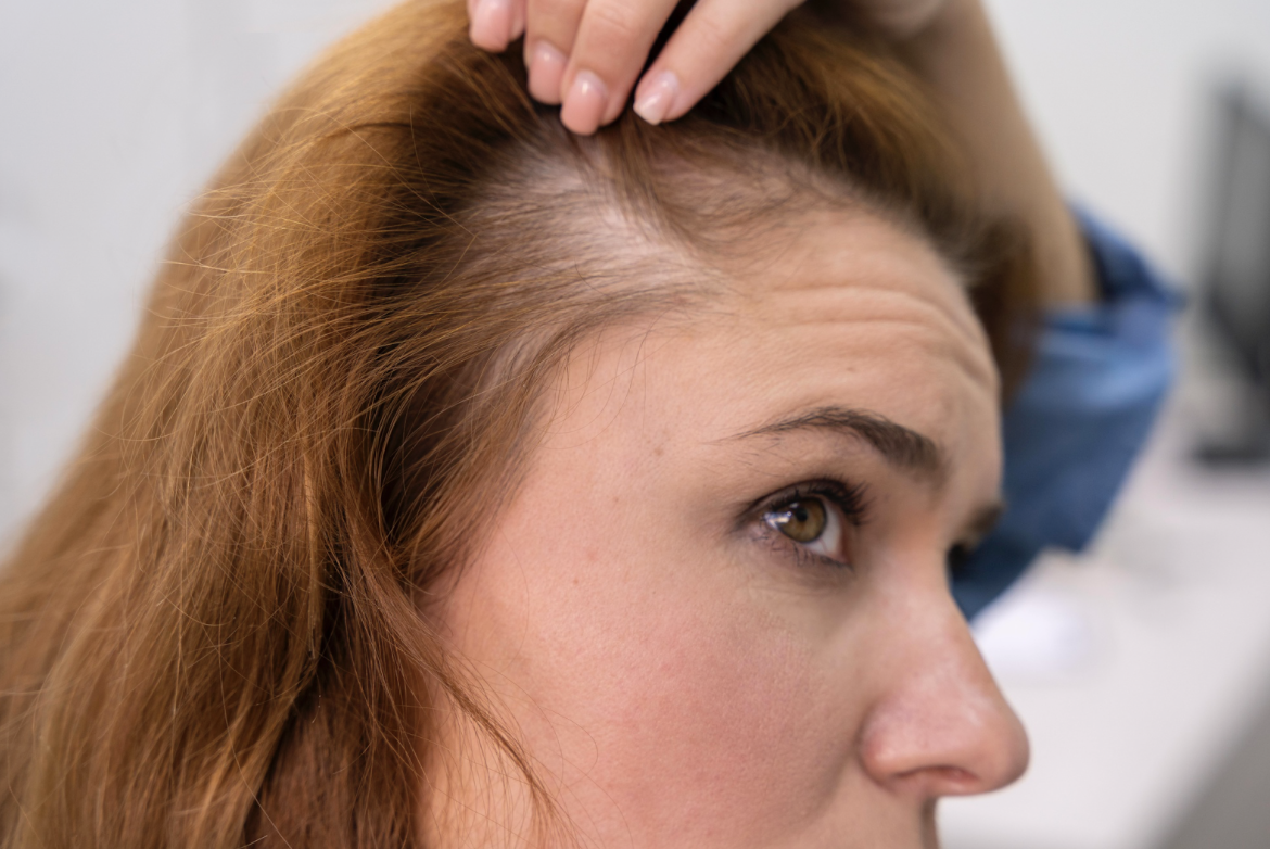Hair Thinning Causes No One Talks About 