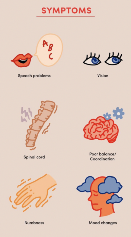 What If Multiple Sclerosis Begins Long Before the Symptoms Do? multiple sclerosis disease causes and management overview