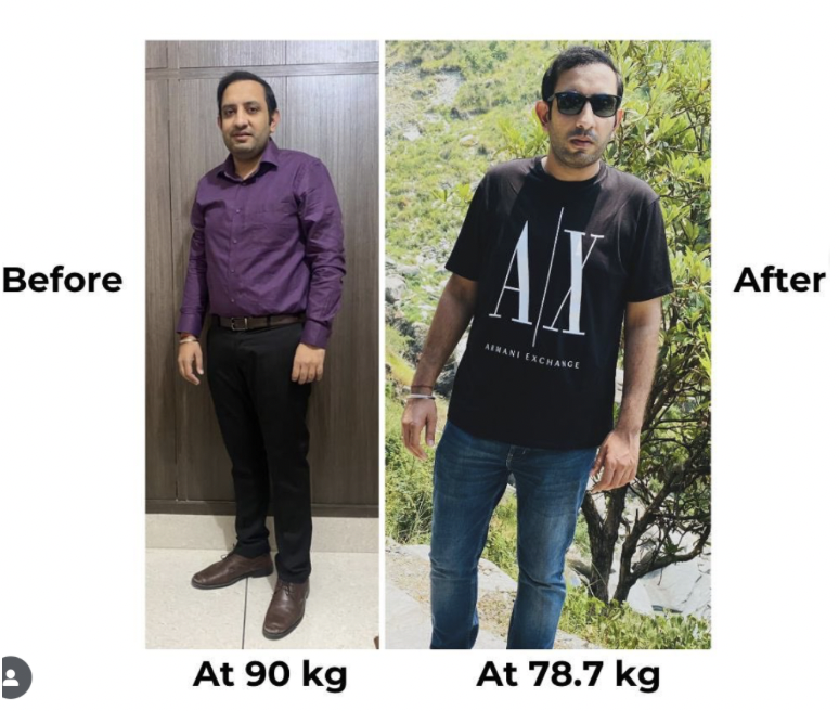 What If Multiple Sclerosis Begins Long Before the Symptoms Do? multiple sclerosis disease showing causes and daily management