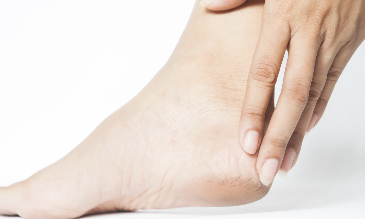 Your Feet Could Be Warning You About Disease — Are You Paying Attention? Your Feet Could Be Warning You About Disease — Are You Paying Attention?