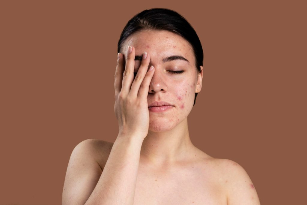 Acne to Ageing: Why Foundational Medicine Is the Missing Link in Skin Health foundational medicine for skin health