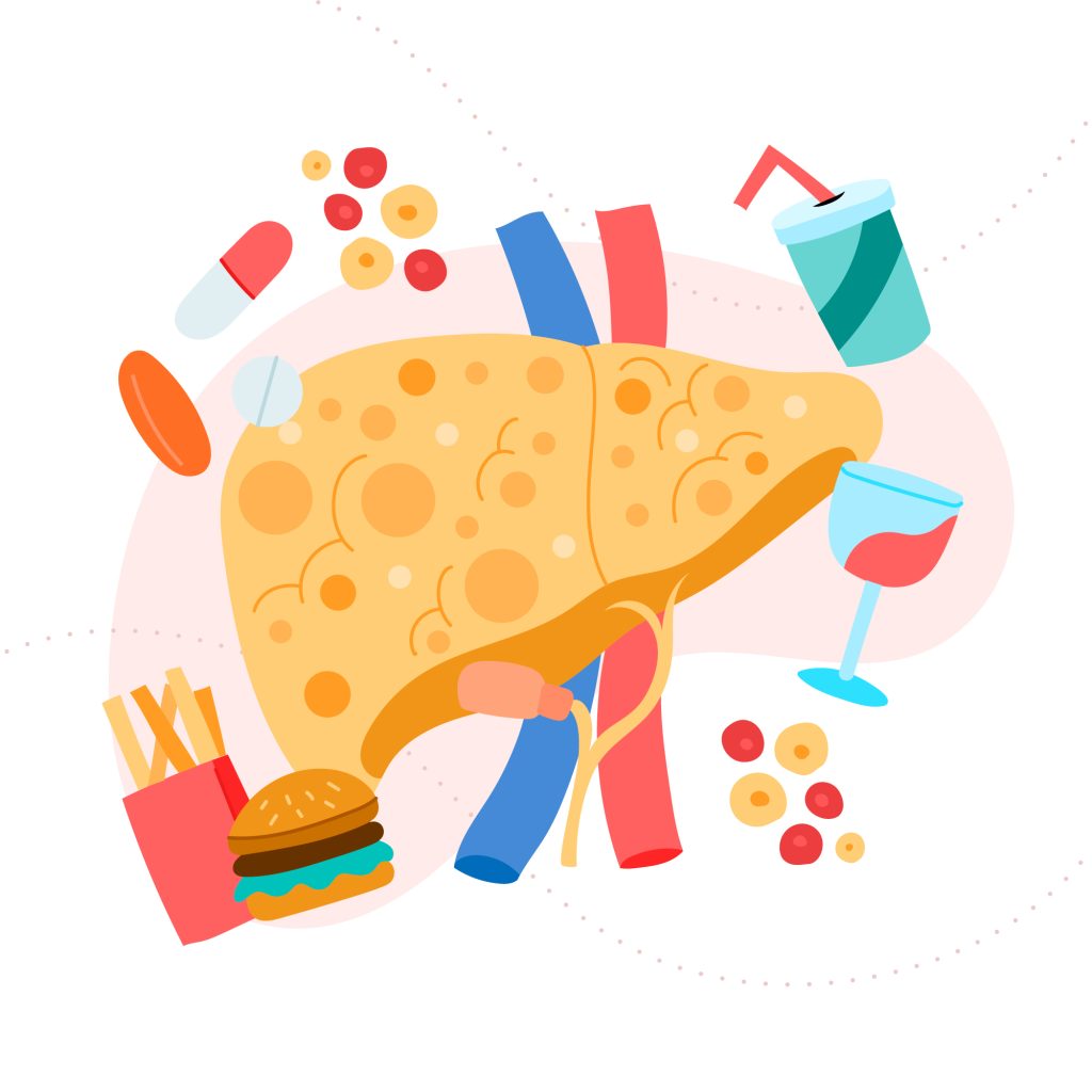fatty liver