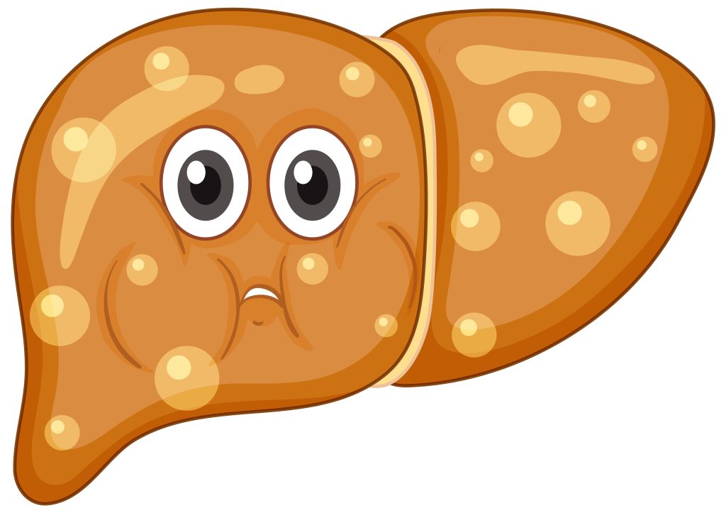 Everyone Blames Sugar for Fatty Liver. But Indians Are Missing the Bigger Problem. fatty liver