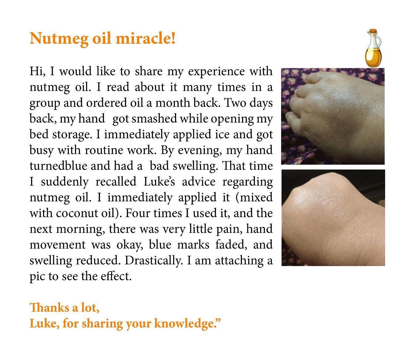 Joint Pain? Sore Muscles? Sprain? Swelling? This Homemade Magic Oil Can Help joint-pain-remedy-nutmeg-oil