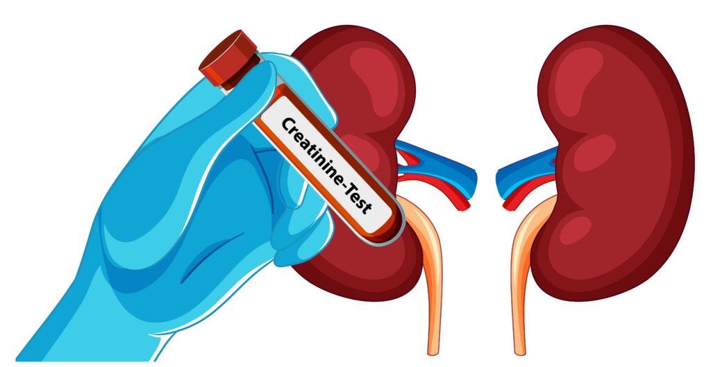 How to Boost Kidney Function Naturally & Cleanse: Your Holistic Approach to Kidney Care kidney care