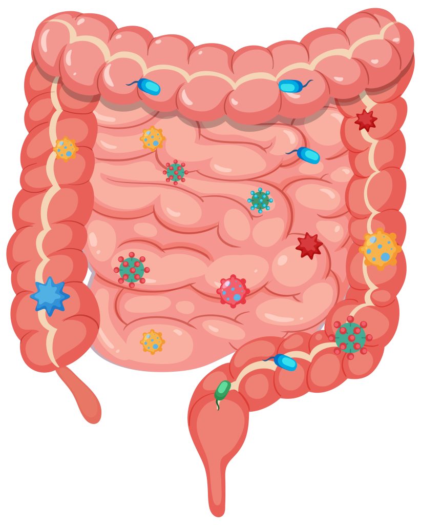 Why Most Gut Care Programs Fail (And What Actually Works) gut microbiome