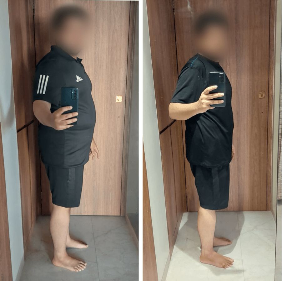 From 103 Kgs to 86.7 Kgs in Just 90 Days: Rahul’s Ultimate Fat Loss Transformation weight loss success story Rahul before and after fat loss transformation