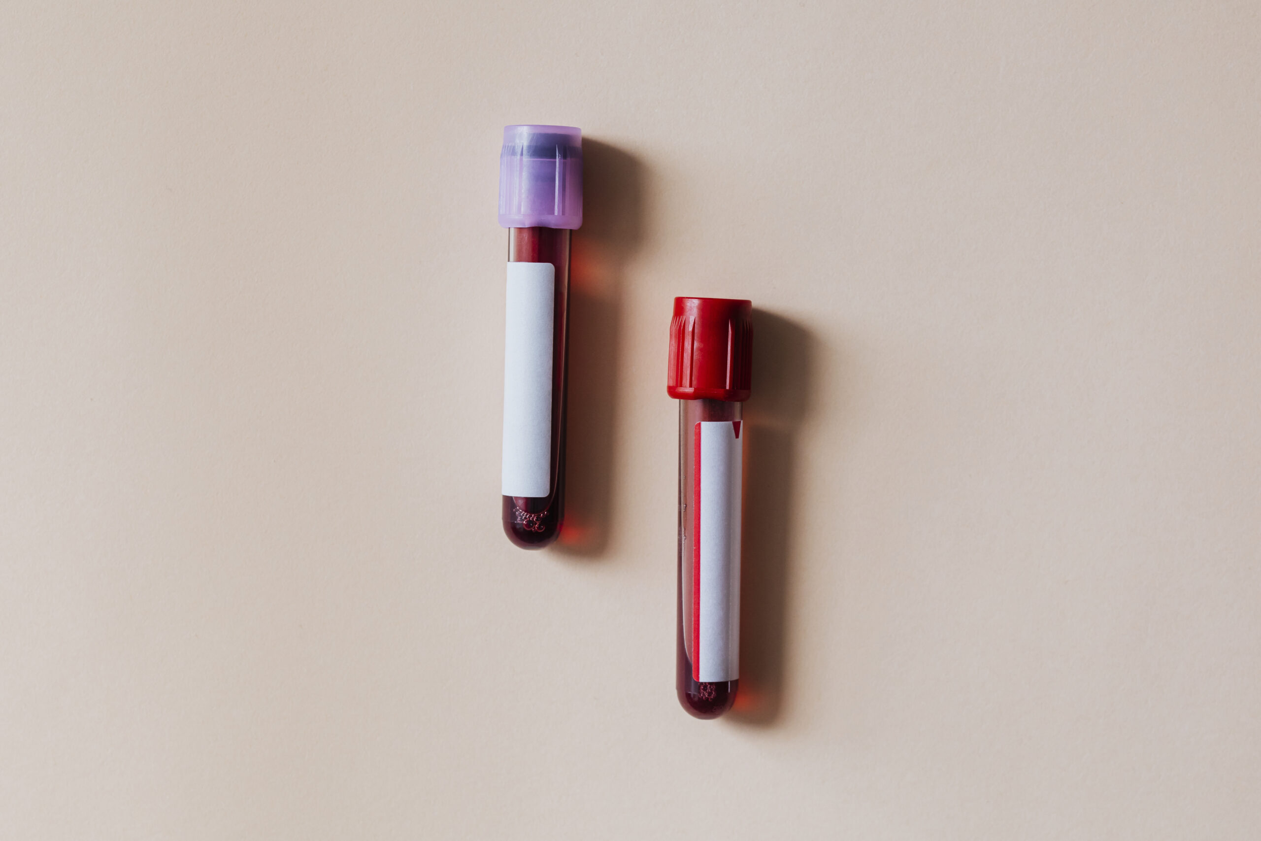 Lipoprotein(a): The One Marker Your Cholesterol Test Isn’t Showing You Think Your Cholesterol is Fine? There’s One Test You Might Be Missing