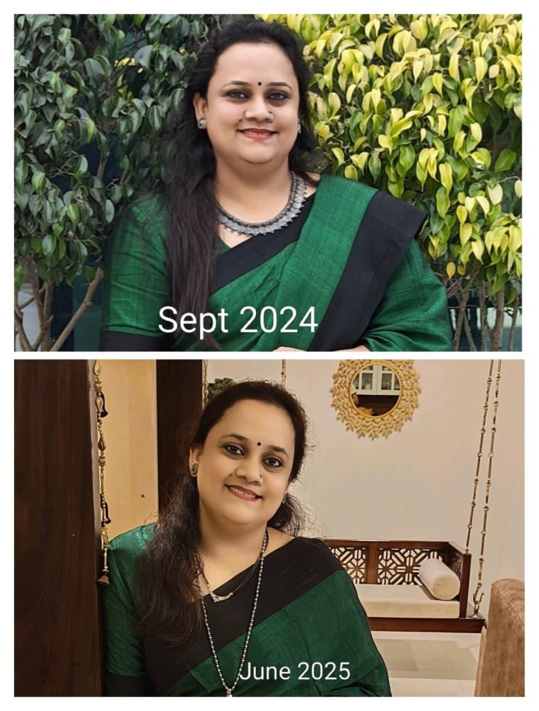 Severe IBS. Migraines. Anxiety. How Shilpa Went From Being Afraid to Step Out to Living Fully Again anxiety and IBS success story