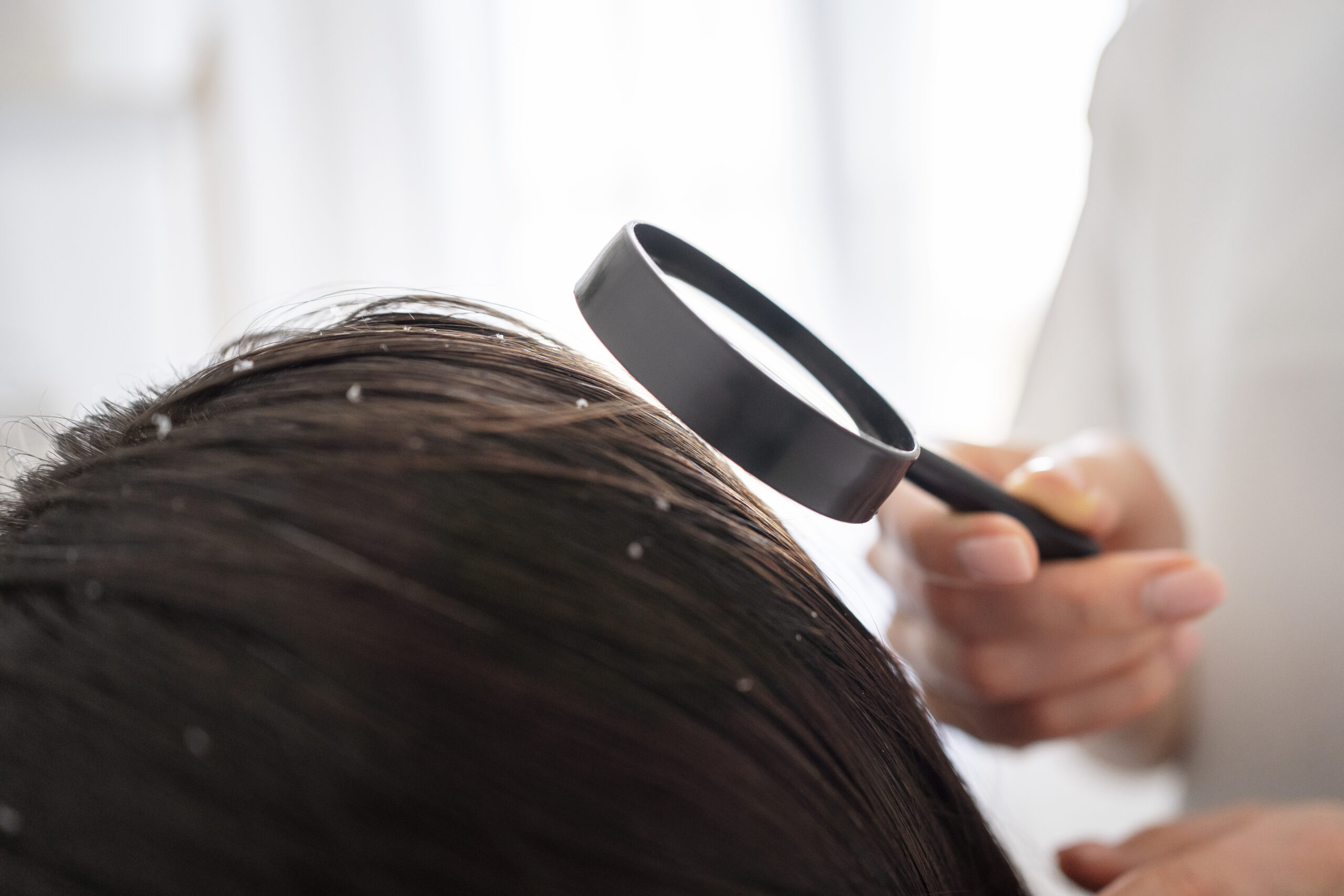 Bad Hair Days? These 5 Scalp Care Secrets Will Change Everything!