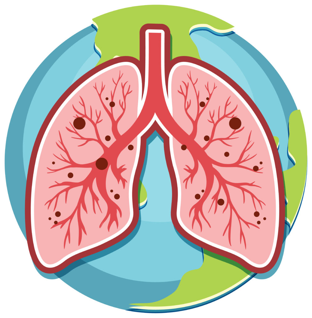 Anti-Inflammatory Foods That Are Good for Lung Health: What to Eat and What to Skip best food for lung cleansing
