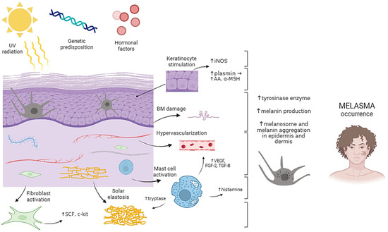 melasma on the face