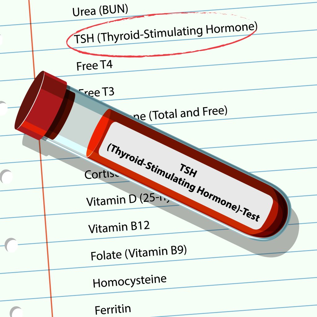 thyroid test preparation guidelines