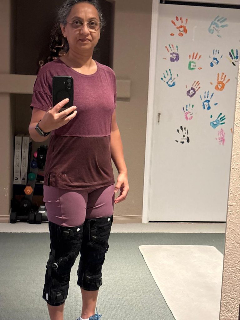 At 51, Menopause and Knee Pain Stole Her Dance—Then Everything Changed osteoarthritis knee pain relief