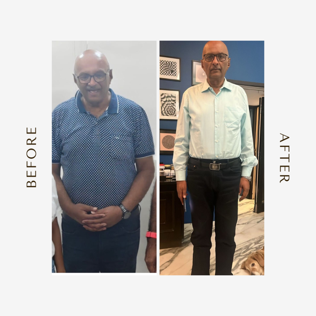 life after kidney cancer surgery