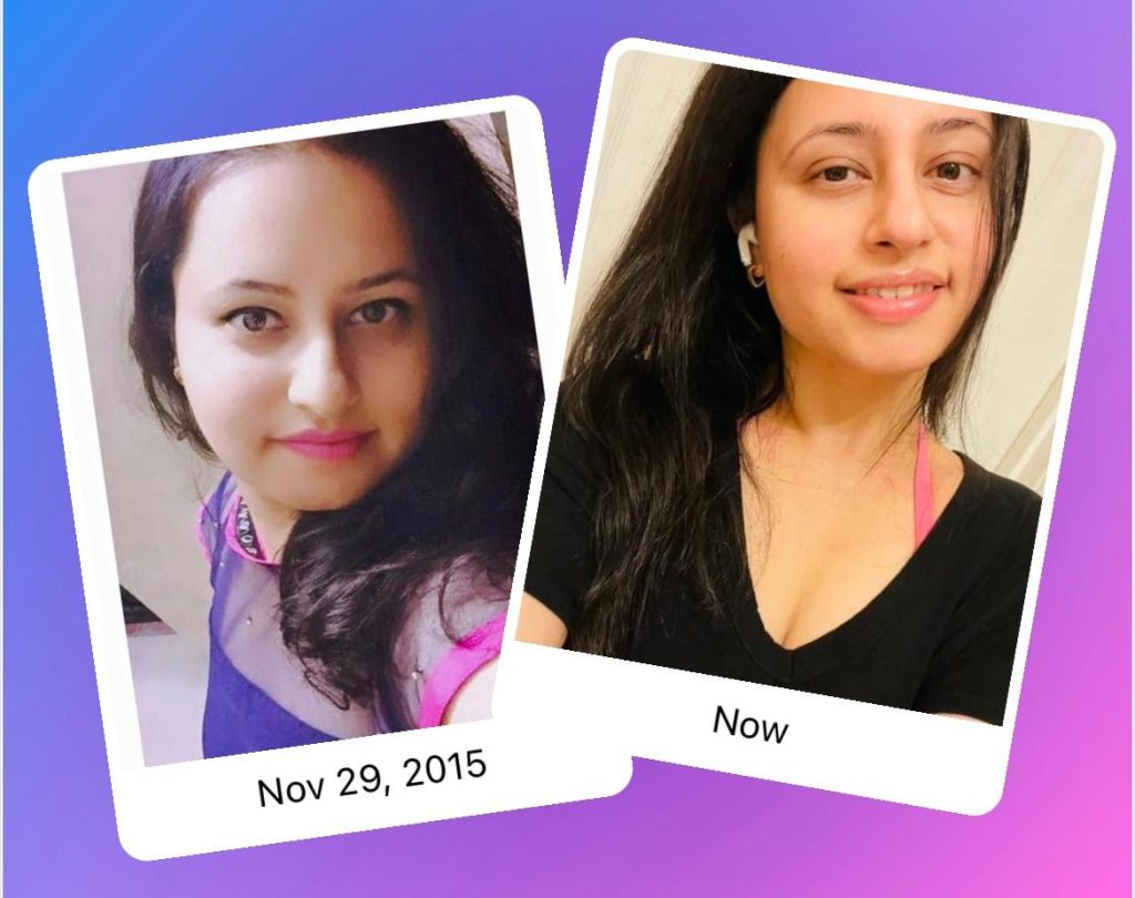 Toshita's PCOS Healing Story: From 60-Day Cycles and 5 Hours of Sleep to a Body She Finally Loves PCOS success story