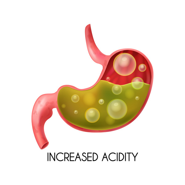 Chronic Acidity Won't Stop Until You Fix These 13 Foundations acid reflux symptoms